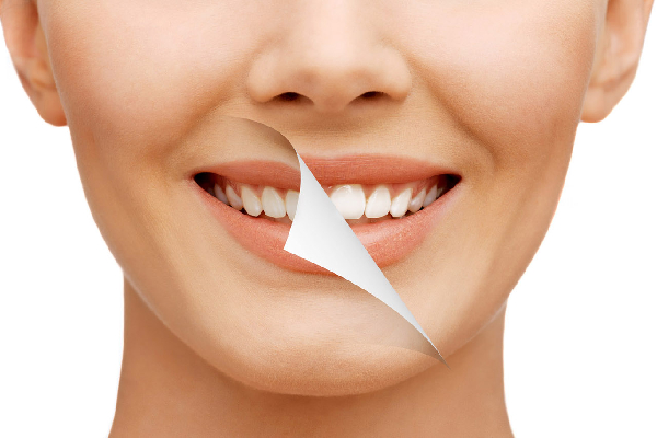 Smile Designing & Cosmetic Dental Treatment